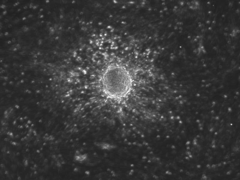 Microscopy image of a stem cell